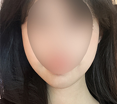얼굴선 변화 굳~