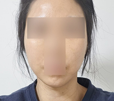 얼굴 라인 깔끔 -