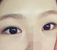 눈잘하는곳이라고 소문났는지 이제야 알겠어요!