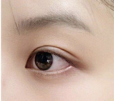 쌍수 두달차 후기 올려용 ㅎㅎ 어때여??