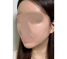 브이라인 됐음당ㅎㅎㅎ