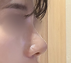 매부리코 박살내고 왔습니다
