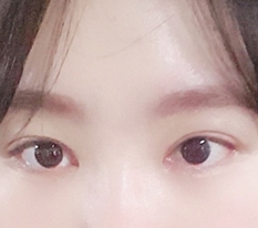 밋밋한 인상 또렷해짐 ㅋ.ㅋ
