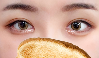 눈재수술, 쌍꺼풀재수술, 앞트임복원, 뒤밑트임