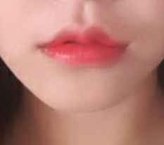 입술성형 현대미학 진짜 강추;