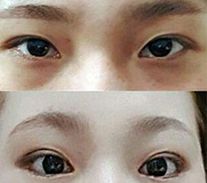 이마거상 하고 넘 잘 되서 후기 남기러 왔어요 ㅎ