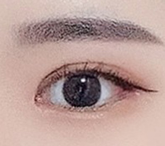 붓기 짱많이 빠지면서 자연스러워졌어욥