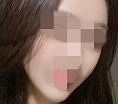 솔직히 광대 하나로 인상이 바뀔까 했는데 많이 바뀌네요 ㅎㅎ