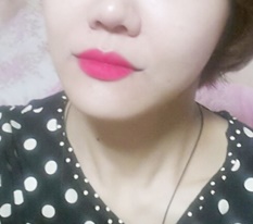 리얼 입꼬리수술 후기!