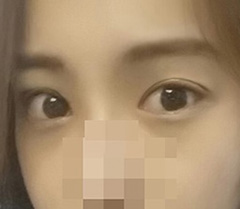 눈재 이제야 만족스러워요!!!♡♥
