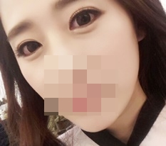 현대미학 눈매교정 강추!~♥