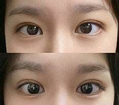 자연유착 눈교 받앗어욤
