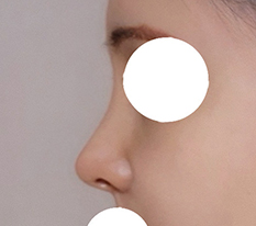 코라인 함 봐주세영