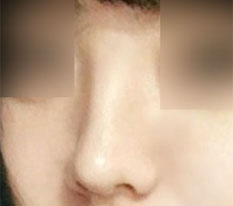 동글동글한 못생긴 코 bye