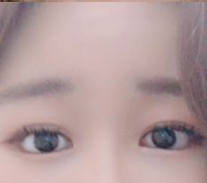 사람들이 트임 왜 하는지 이제 알 것 같아요 ^^