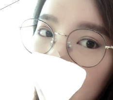 눈재수술 후기 쪄왓어요 따끈따끈~