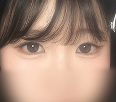 뒤밑트임 시원하게