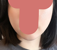 얼굴선정리 속시원하네용