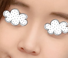 코성형 후 연애해요~