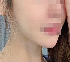 얼굴형 매끈ㅎㅎ