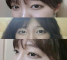 재수술고민많았는데.. 이젠 자신감넘치는 예쁜눈매♥