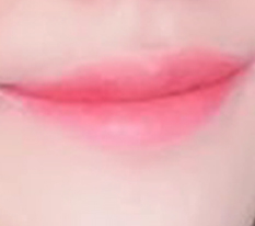 입꼬리수술 덕분이에용