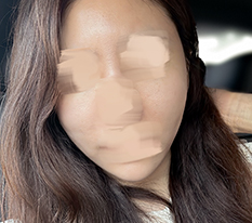 브이라인 자연스럽게