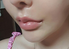 입꼬리 완전 변했어요!!