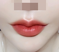 입꼬리 예뻐짐ㅋ