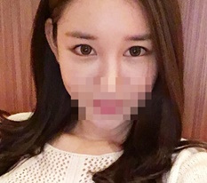 눈 뒤트임 밑트임 후기올려욤