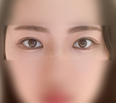 짝눈 맞춰졌어요 ㅋㅋ