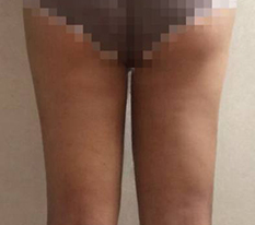 하비탈출엔 지흡이 답