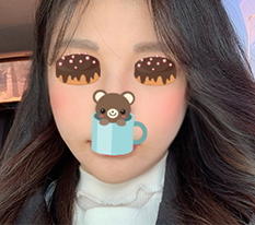 다시 한 광대수술 예뻐요^^
