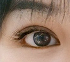 수술 할까말까 고민이신분들 그냥 지르세요~!!!