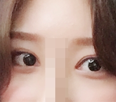 역시 눈성형 잘하시는거 인정해용*=_=*!!!