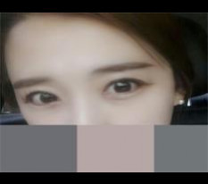 절개와 올트임 후기입니다아