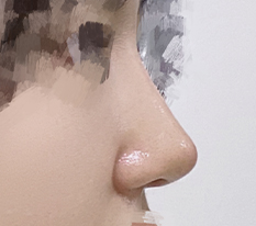 코수술하길 잘한듯ㅎㅎ