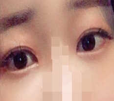 듀얼트임,앞트임
