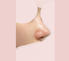 뭉똥코 해결