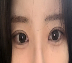 대빵 왕눈 됐어요!