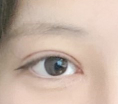 쌍수하고 새 인생 사네요ㅠㅠ