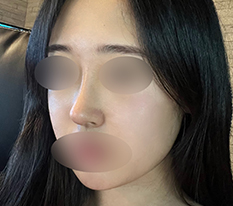 자려한 코 겟