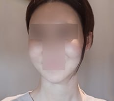 얼굴형 돌아왔어요ㅎㅎ