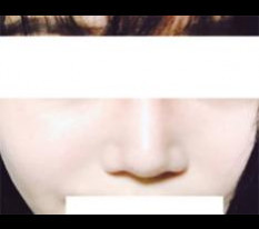 오똑한 코로 변신했어요ㅎㅎㅎ♥
