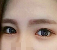 눈만 했을 뿐인데 다시 태어난 기분이에용 ㅠㅠ