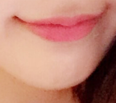 못난이입술탈출