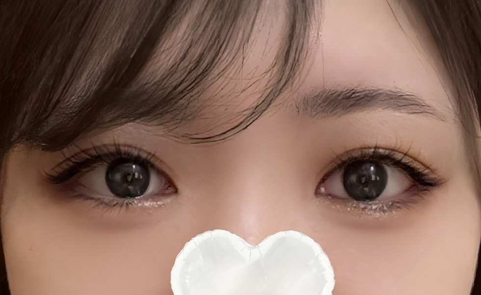 소세지눈 재수 성공!
