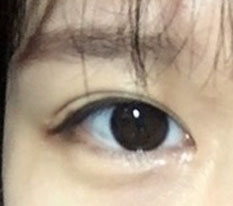 원장님 덕분에 제 눈이 예뻐졌어요