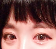 트임 완전 짱