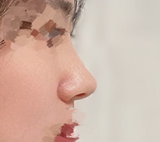 여리한 코 완성